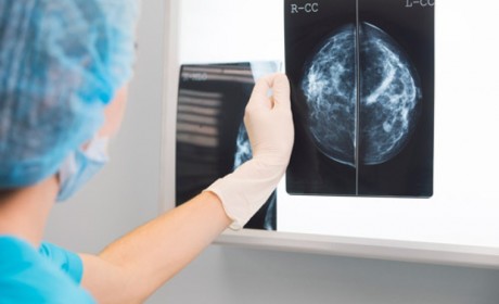 研究揭示人工智能帮助检测乳腺癌
