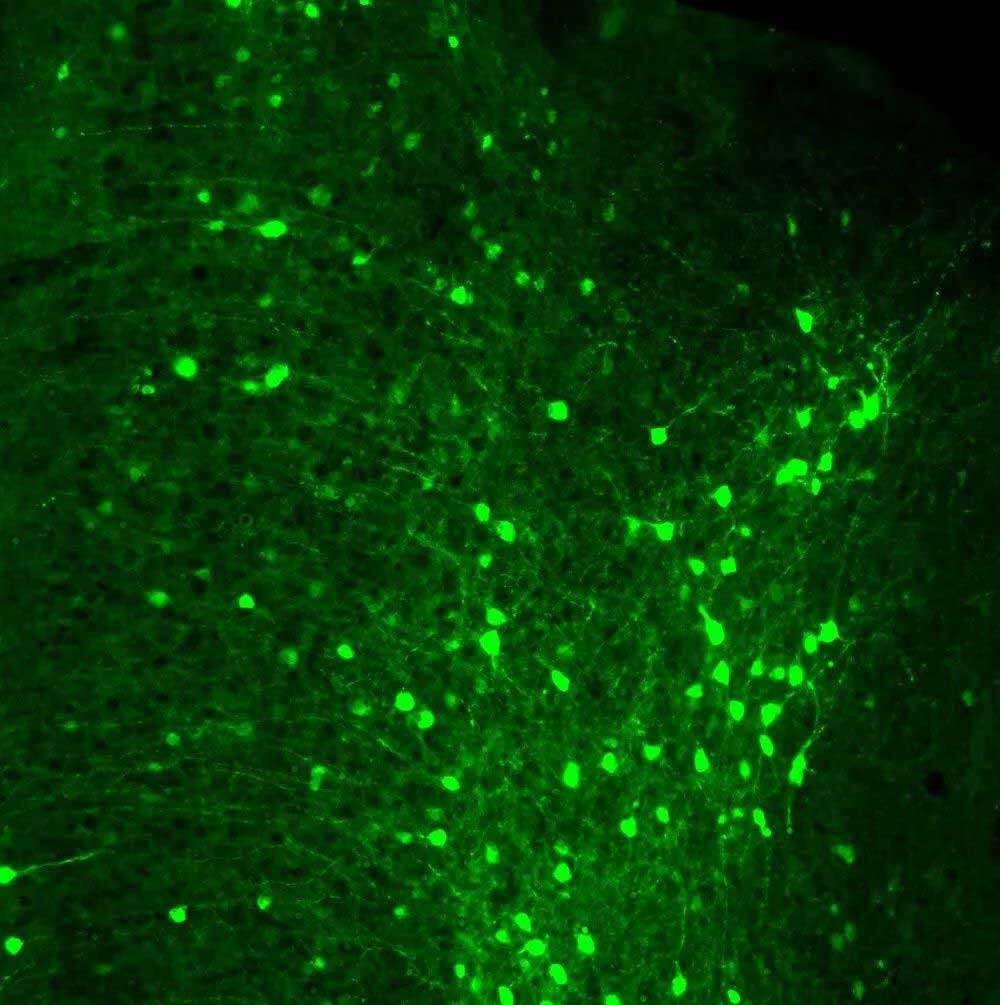 NTU研究 | 衰老过程如何改变脑细胞功能以保持记忆